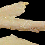 LIGAMENTUM NUCHAE